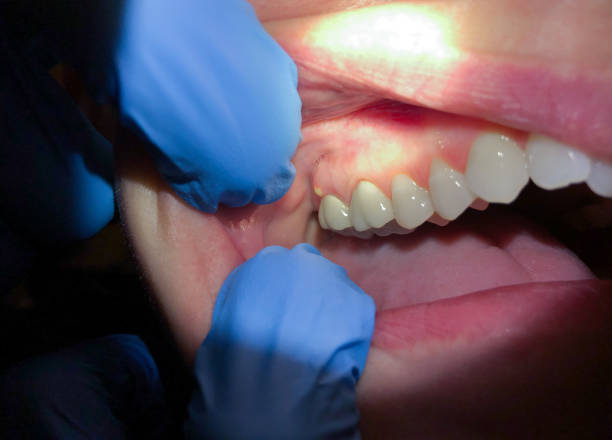 Best Urgent Tooth Repair  in Islandia, NY
